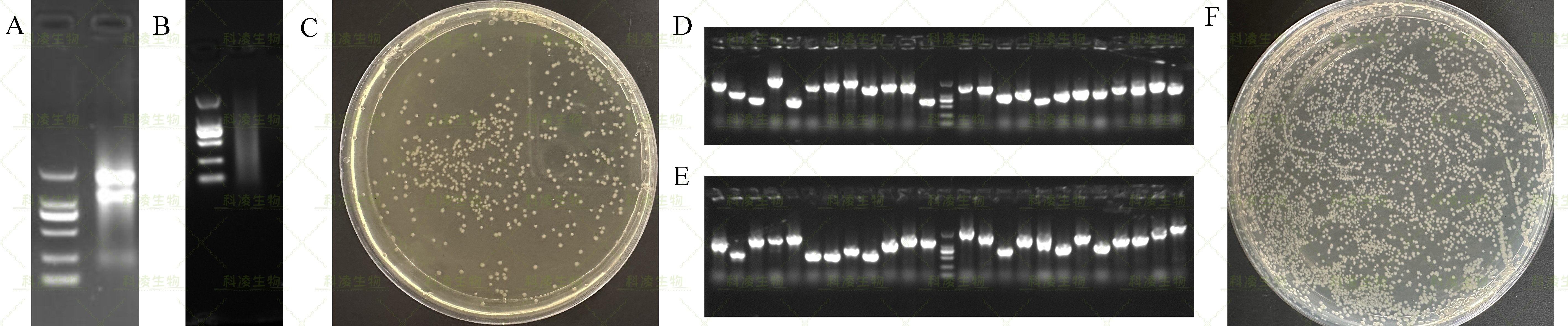 13酵母建库.jpg 13酵母建库.jpg